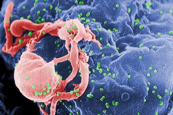 The new AIDS epidemic: Pushing past Putin